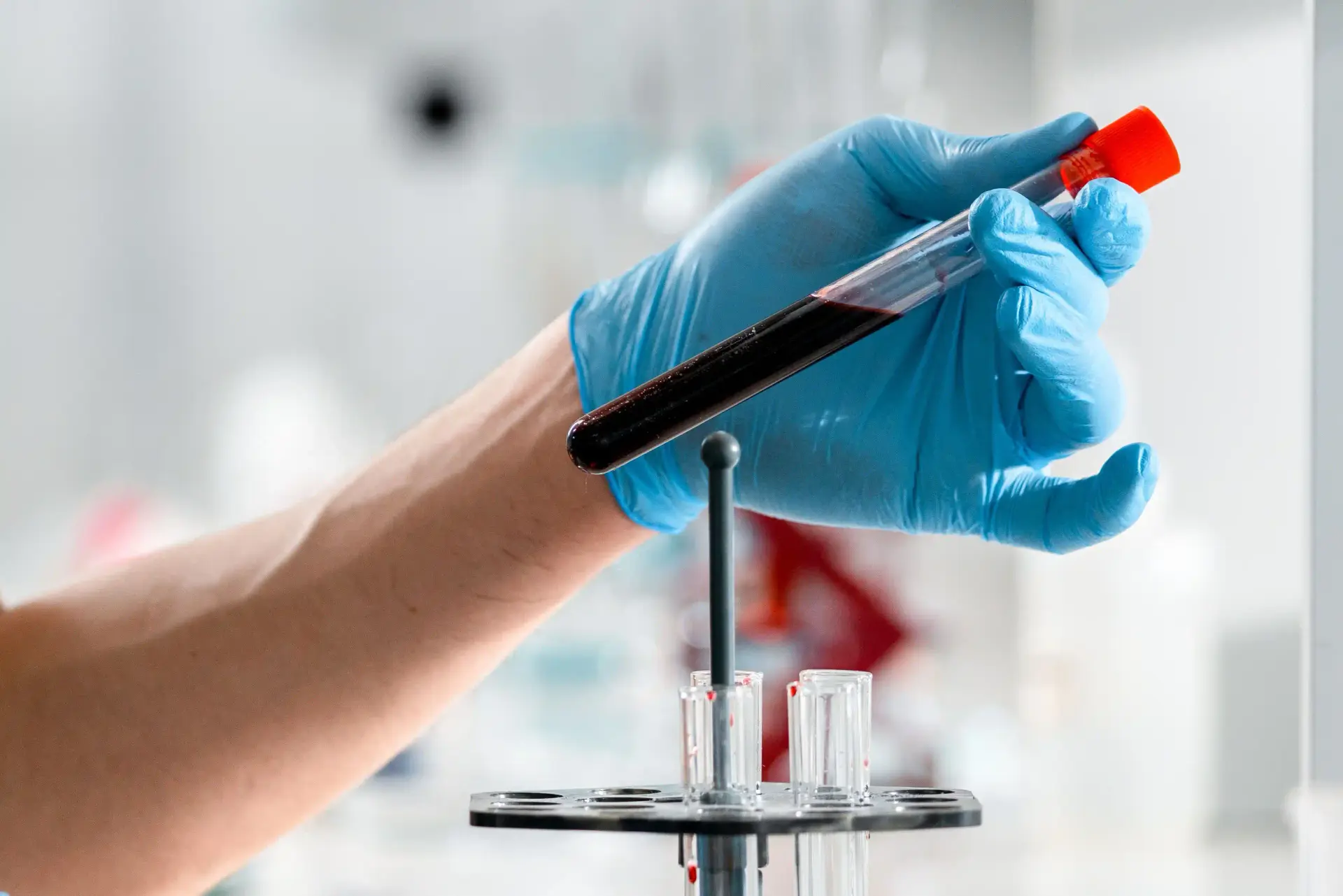 Kisspeptin: Master Regulator of Testosterone, Libido, Fertility, and Reproductive Hormones (Research Guide)